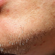Illustration for article titled Whose Disgusting Baseball Chin Is This?